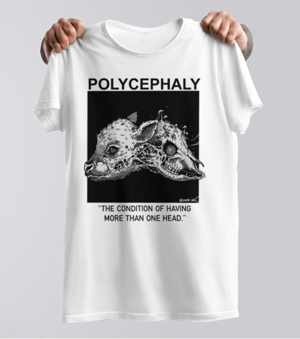 Polycephaly The Condition Of Having More Than One Head T-Shirt